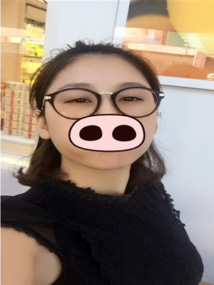 注射瘦臉去眉間紋真實案例分享——?？诩t妝李科醫(yī)生做的