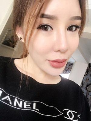 高強度聚焦超聲手術三個月的前后恢復記錄——?？诩t妝李科做的