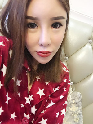 高強度聚焦超聲手術三個月的前后恢復記錄——?？诩t妝李科做的