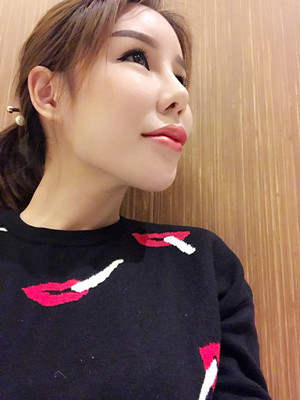 高強度聚焦超聲手術三個月的前后恢復記錄——?？诩t妝李科做的