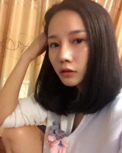 隆鼻整形真實(shí)恢經(jīng)歷 曬圖啦！