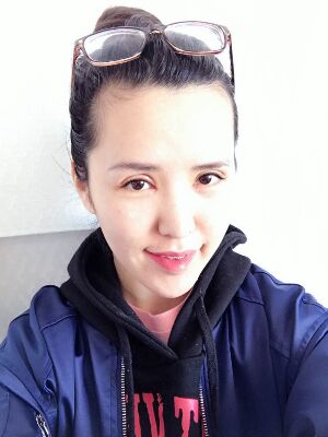 全切雙眼皮修復(fù)恢復(fù)后圖片，寬度較為合適喲