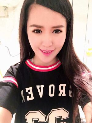 全切雙眼皮修復(fù)恢復(fù)后圖片，寬度較為合適喲