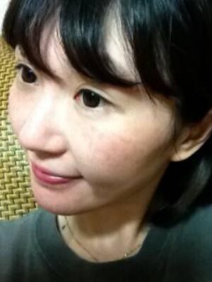 激光去雀斑果好不好，真實案例告訴你