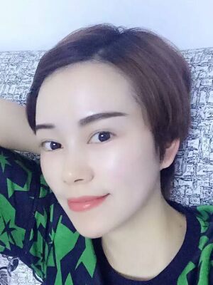 點陣激光祛痘后果對比圖，皮膚光滑多了