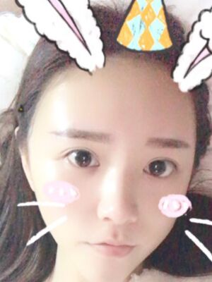 自體脂肪詳細(xì)部填充日記，恢復(fù)過(guò)程分享