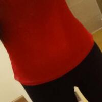 吸脂減肥瘦腰腹不反彈，恢復過程圖分享