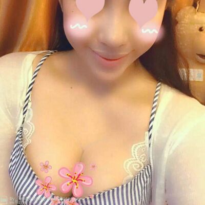 自體脂肪豐胸對比照片，福州愛美爾張勝利做的