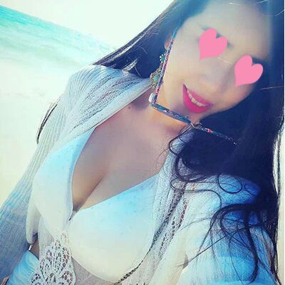 自體脂肪豐胸對比照片，福州愛美爾張勝利做的