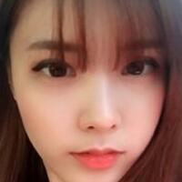 做了割雙眼皮和開內(nèi)眼角雙眼皮多項整形整形手術(shù)，恢復(fù)圖片日志分享