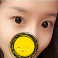 注射瘦臉去抬頭紋果不錯(cuò)——濟(jì)南吉芙美容整形醫(yī)院