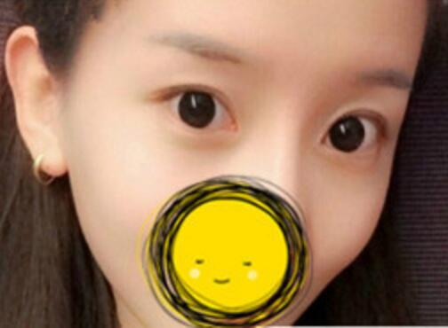 注射瘦臉去抬頭紋果不錯——濟(jì)南吉芙美容整形醫(yī)院