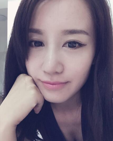 哈爾濱假體隆鼻價(jià)格8900元,隆鼻真實(shí)案例分享