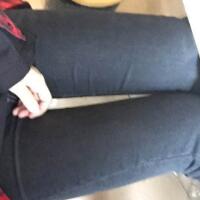 吸脂塑身醫(yī)院推薦歐蘭仁美醫(yī)院，吸脂瘦腿恢復(fù)圖分享