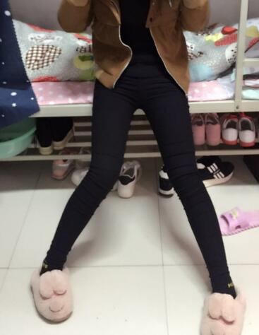 吸脂塑身醫(yī)院推薦歐蘭仁美醫(yī)院,吸脂瘦腿恢復圖分享