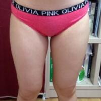抽脂減肥瘦大腿價格10800元，一個月后恢復(fù)很好
