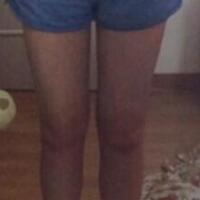 抽脂減肥瘦大腿價格10800元，一個月后恢復(fù)很好