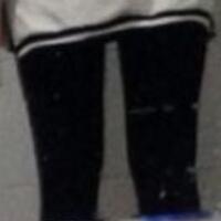 抽脂減肥瘦大腿價格10800元，一個月后恢復(fù)很好