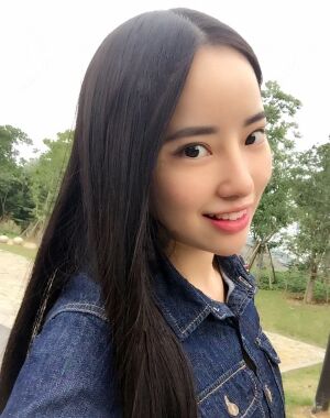 貴陽(yáng)美萊梁潔隆鼻整形兩個(gè)月果圖