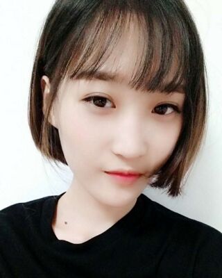 微創(chuàng)全切雙眼皮果對(duì)比照片，貴陽麗都葛志鑫手術(shù)案例