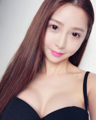 美國曼托假體隆胸手術(shù)果圖，貴陽麗都李觀龍做的