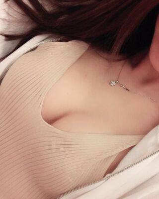 美國曼托假體隆胸手術(shù)果圖，貴陽麗都李觀龍做的