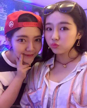 武漢美亞金國(guó)華醫(yī)生幫我做的自體脂肪全臉填充果恢復(fù)案例