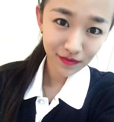 注射瘦臉去抬頭紋眉間紋恢復(fù)過程圖,真實案例分享