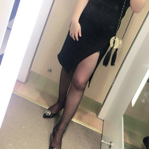 青?？等A馮相周醫(yī)生大腿抽脂案例分享