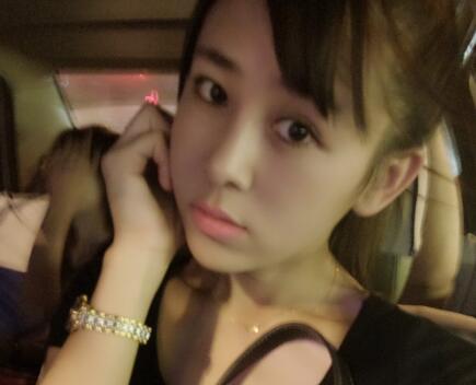 鼻翼縮小手術(shù)對比圖分享——四川悅好整形