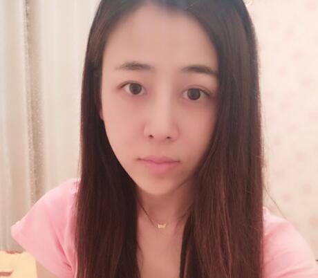 鼻翼縮小手術(shù)對比圖分享——四川悅好整形