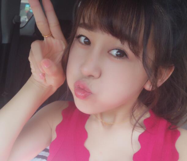 鼻翼縮小手術(shù)對比圖分享——四川悅好整形