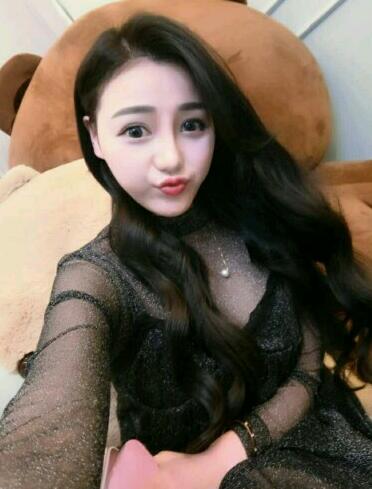 上海九院李圣利隆鼻整形真實(shí)恢復(fù)期圖片