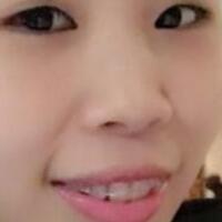 牙齒矯正的適宜年齡，多對(duì)比圖真實(shí)案例分享——成都格林口