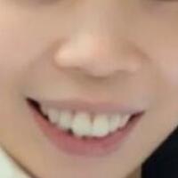 牙齒矯正的適宜年齡，多對(duì)比圖真實(shí)案例分享——成都格林口