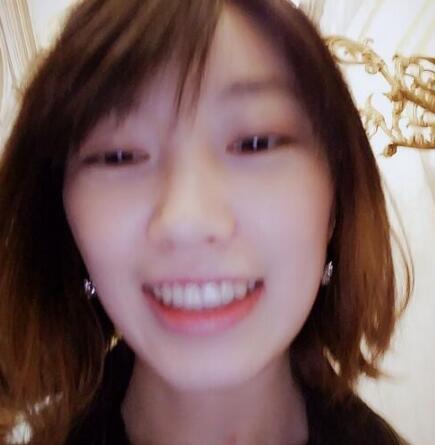 牙齒矯正前后對(duì)比圖,成人牙齒矯正費(fèi)用9800元——成都格林口腔醫(yī)院