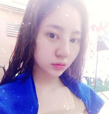 隆鼻整形前后對比圖和恢復(fù)過程