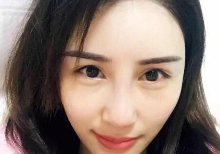 鼻子綜合整形前后對比圖