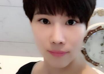 杭州悅可整形醫(yī)院做隆鼻失敗修復(fù)恢復(fù)過程和對比圖分享