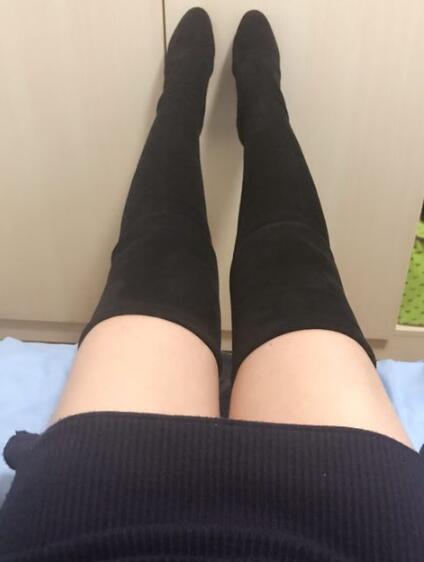 吸脂減肥瘦大腿前后對比圖,光纖溶脂瘦大腿較有的方法真實案例