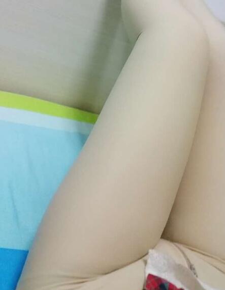 吸脂減肥瘦大腿前后對比圖,光纖溶脂瘦大腿較有的方法真實案例