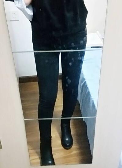 吸脂減肥瘦大腿前后對比圖,光纖溶脂瘦大腿較有的方法真實案例