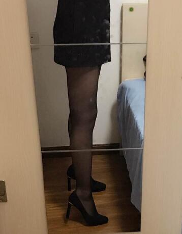 吸脂減肥瘦大腿前后對比圖,光纖溶脂瘦大腿較有的方法真實案例