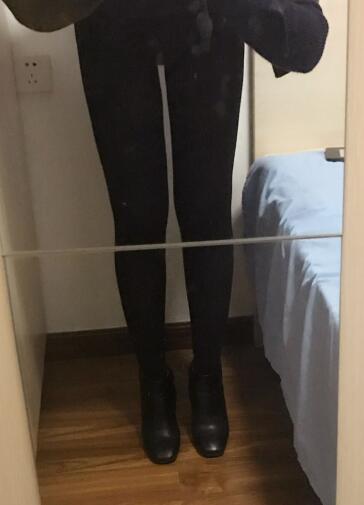 吸脂減肥瘦大腿前后對比圖,光纖溶脂瘦大腿較有的方法真實案例