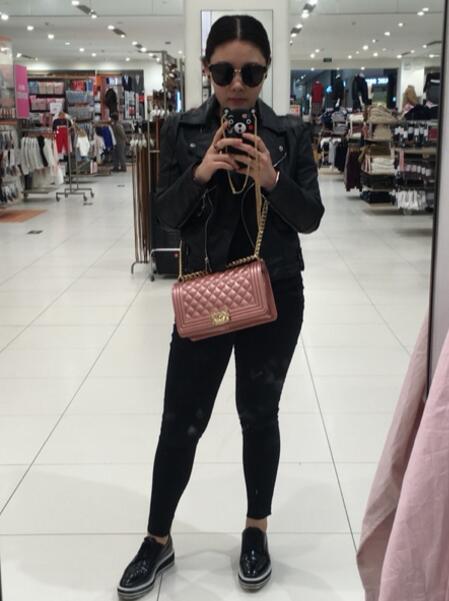 水動力吸脂減肥瘦大腿手術(shù)前后對比圖和恢復(fù)過程