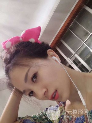 分享我的激光祛眼袋手術前后過程，廈門思明安黛美林韻醫(yī)生做的