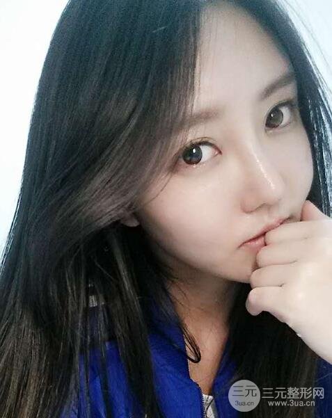 自體脂肪面部填充價位和案例