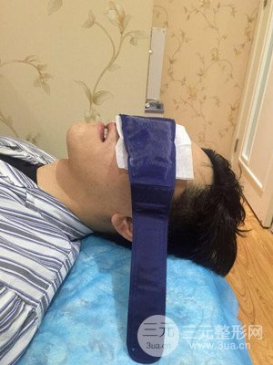 深圳南西子袁新平醫(yī)生給我做的祛眼袋手術(shù)，真實案例以及前后對比照片分享