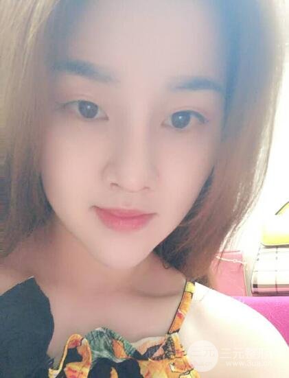 蒜頭鼻整形價格和對比照片案例