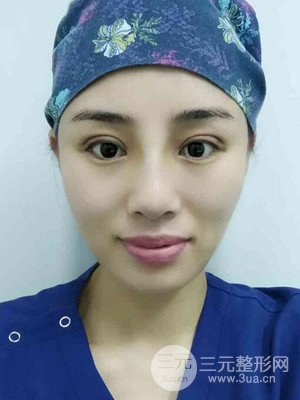 青?？等A馬晶醫(yī)生給我做的硅膠假體隆鼻+雙眼皮手術(shù)，分享一下前后對比圖